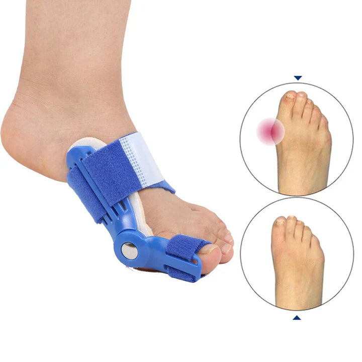 Hallux Valgus Splint Set, Corrective Alignment