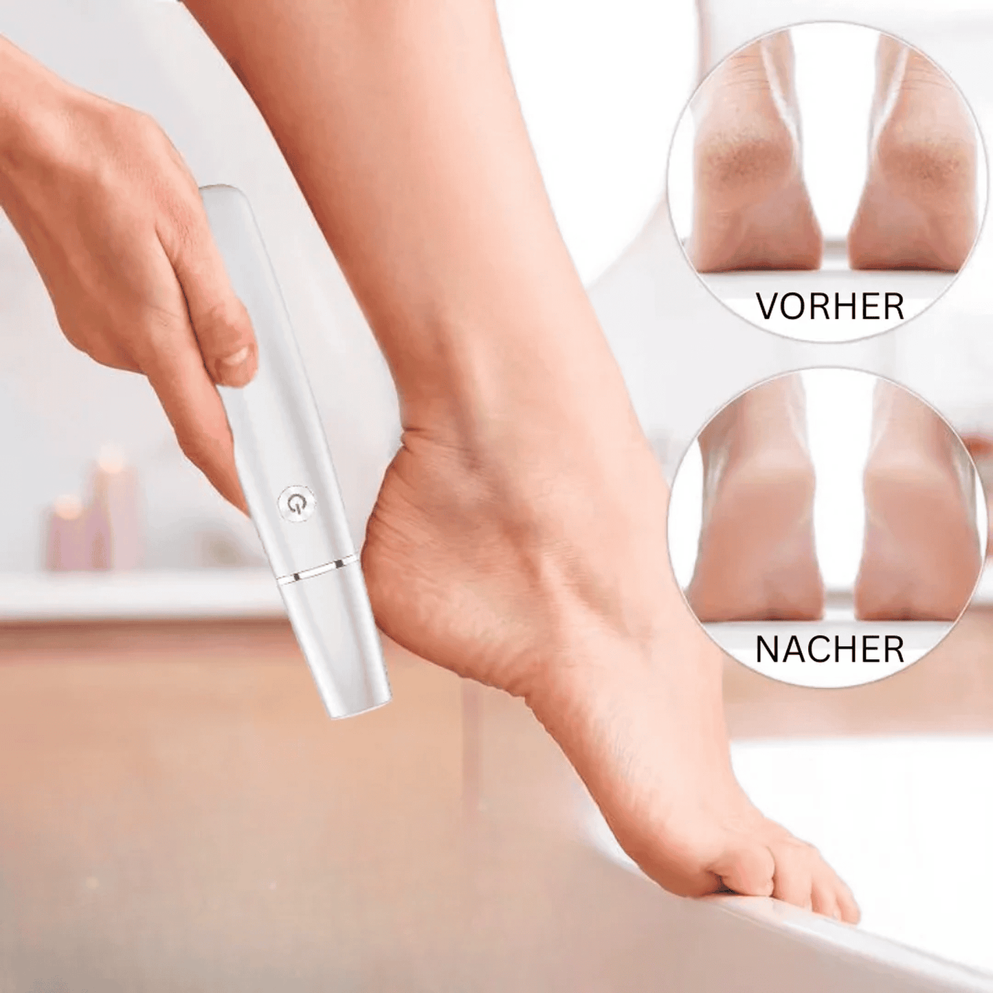 Efficient Electric Callus Remover, Gentle Foot Care