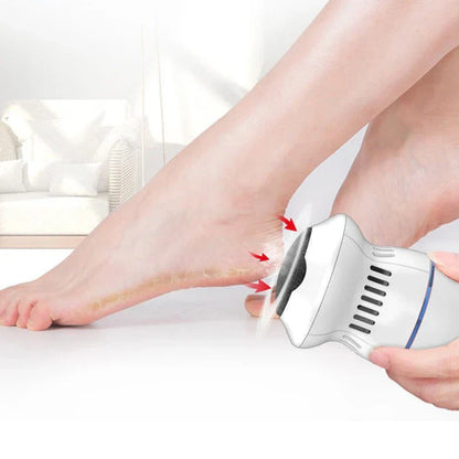 Electric Callus Remover, Professional Grade