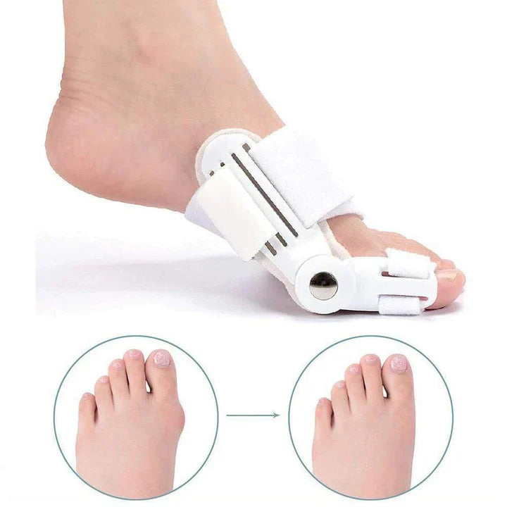 Hallux Valgus Splint Set, Corrective Alignment