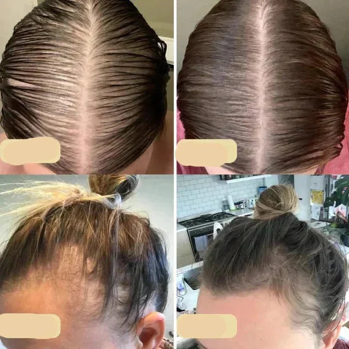 Natural Hair Growth Oil, Plant-Based Booster for Nourishing Growth