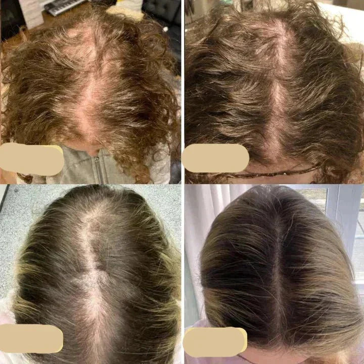 Natural Hair Growth Oil, Plant-Based Booster for Nourishing Growth
