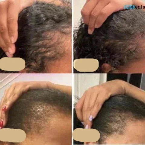 Natural Hair Growth Oil, Plant-Based Booster for Nourishing Growth